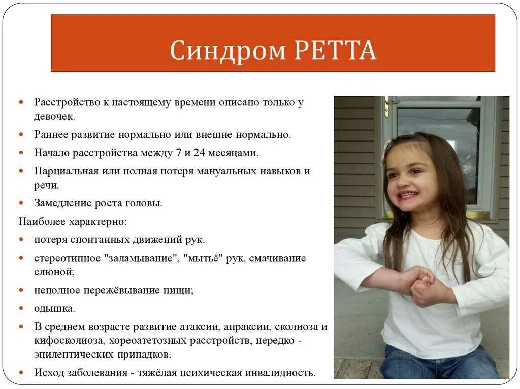 Что такое синдром опасна. Синдром ретта. дети с синдромом ретта. синдром ретта у детей симптомы.