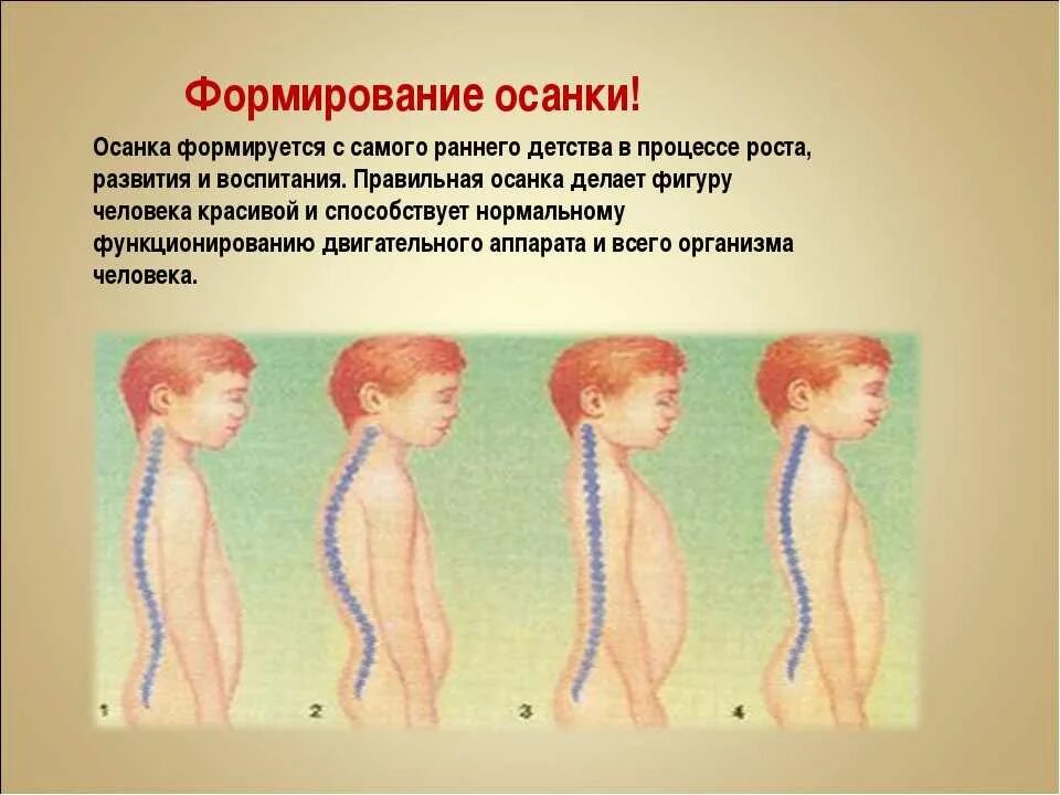 До скольки формируется человек. Формирование правильной осанки. Формирование осанки у детей. Формирование правильной оценку у детей. Формирование неправильной осанки.