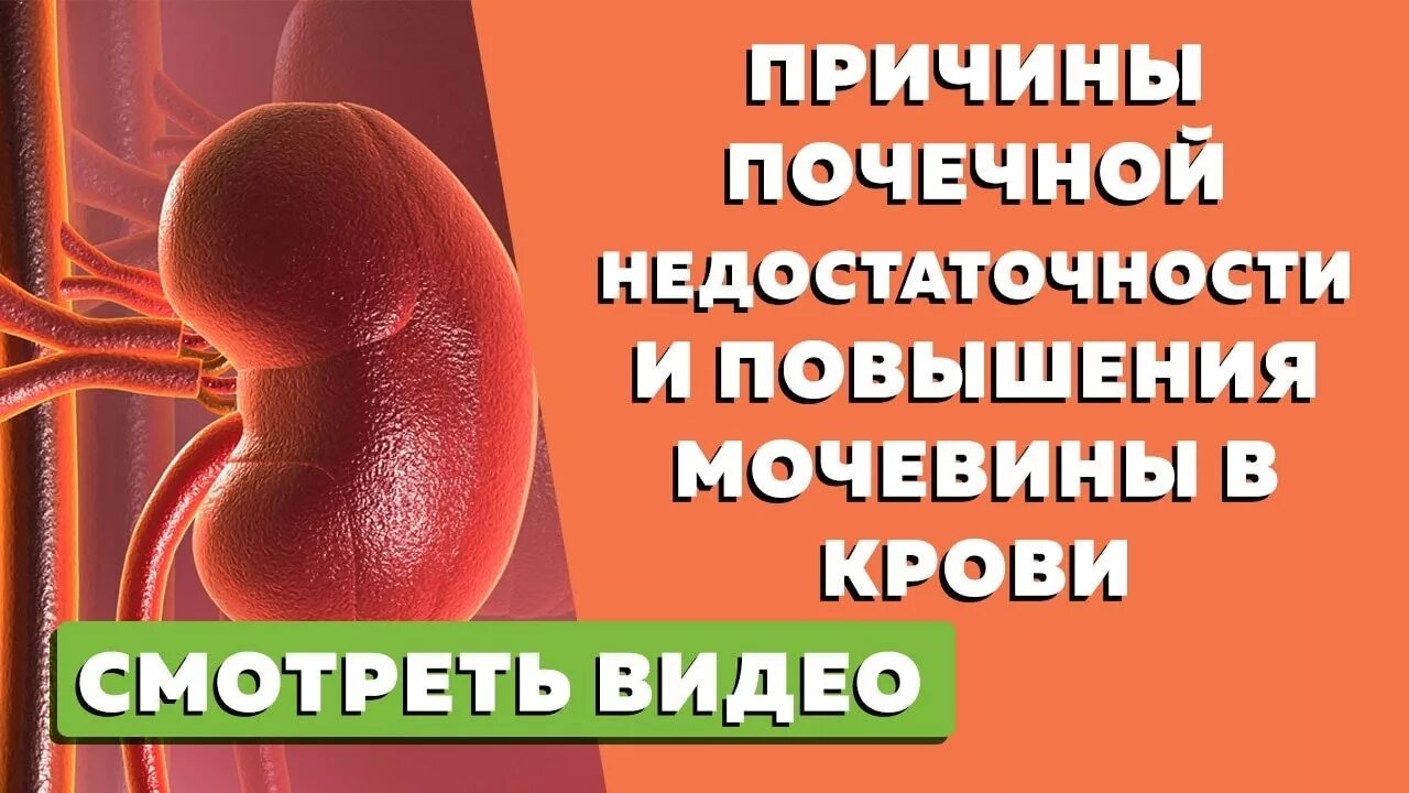 Повышенная мочевина в крови у мужчин лечение. Мочевина почки. Повышение мочевины в крови. Лекарство для понижения креатинина. Креатинин почки.