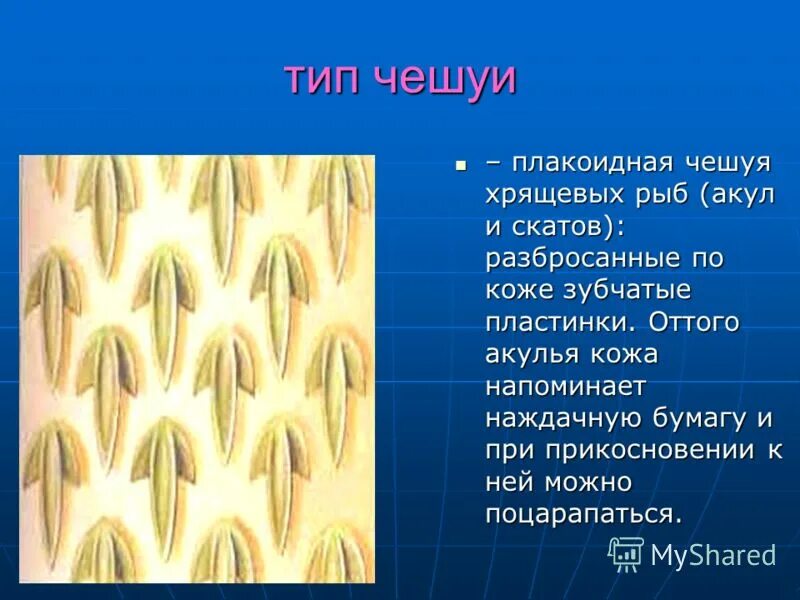 плакоидная чешуя. строение чешуи костных рыб. костная чешуя строение. чешуя покрыта эмалью. кожа покрыта примитивными плакоидными пластинками.