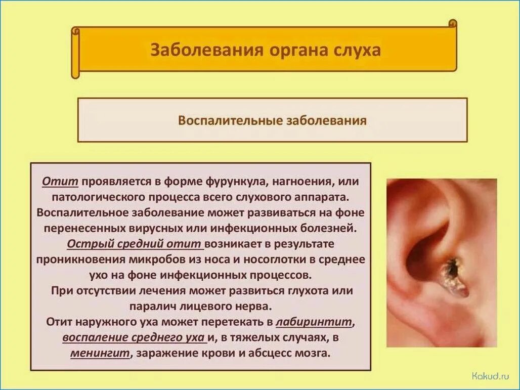 Слуховой анализатор болезни отит. Заболевание органов слуха доклад 8 класс биология. Строение уха и средний отит. Заболевания наружного уха отит наружный. Болезни органов слуха