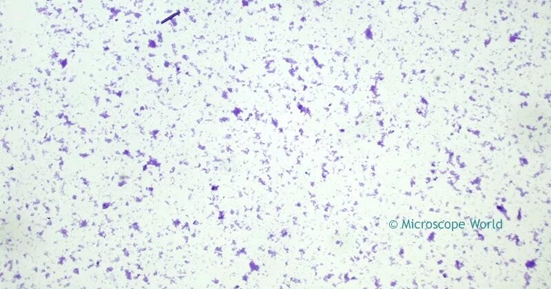 Lachnobacterium spp
