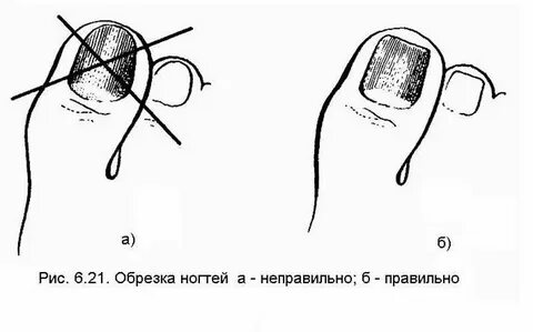 Как подстричь жесткие ногти