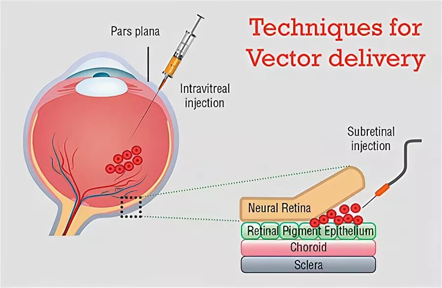 Intravitreal administration
