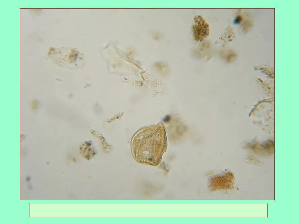 Препараты пыльцы. Пыльца микроскопия. Палинология. Палинология фото. Строение пыльцы палинология.
