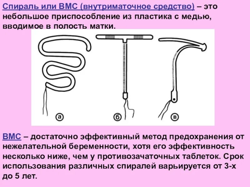 Спираль ВМС. Спираль внутриматочная. Спираль от беременности. Спираль внутриматочная СССР.
