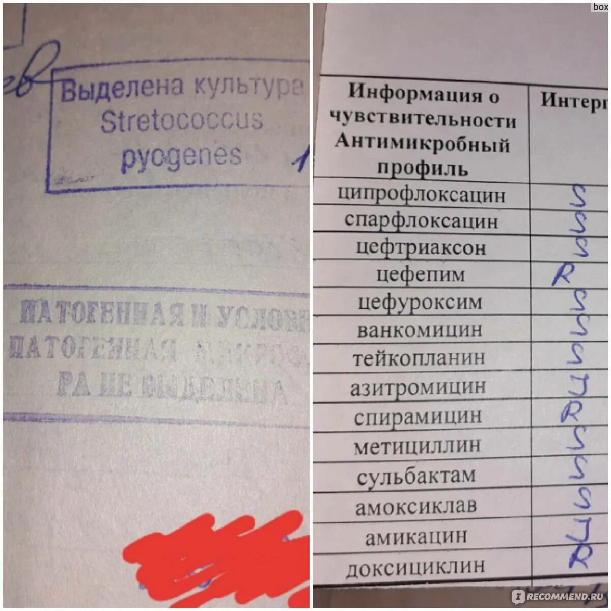 Мазок на микрофлору из горла посев. Мазок из носоглотки на инфекции. Анализ из горла на инфекции. Сдать на посев мазок из носа. Сдать анализы после ковида