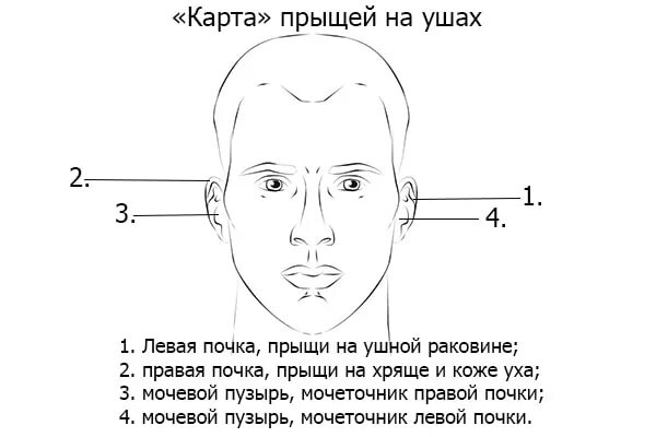 Прыщ на правой стороне примета. Угревая сыпь в ушной раковине. Почему выскакивают прыщи в ушах. Подкожный прыщ на мочке уха.