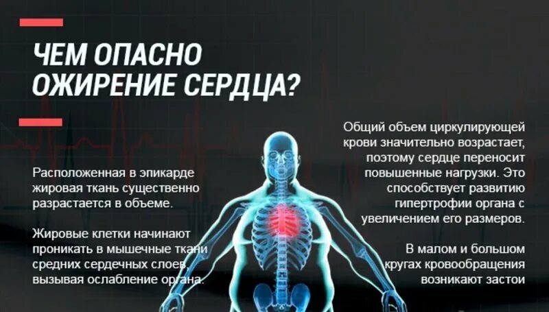 Ожирение и сердечно сосудистые заболевания. Влияние лишнего веса на сердечно сосудистую систему. Ожирение и сердечно сосудистая система.