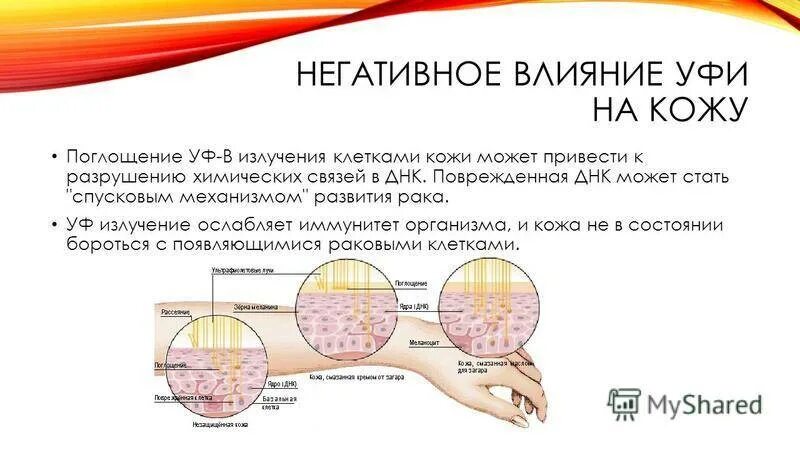 Можно ли после солнечного. Влияние ультрафиолетового излучения на кожу. Воздействие УФ лучей на кожу. Воздействие солнечных лучей на кожу человека. Солнечное излучение и влияние на кожу.