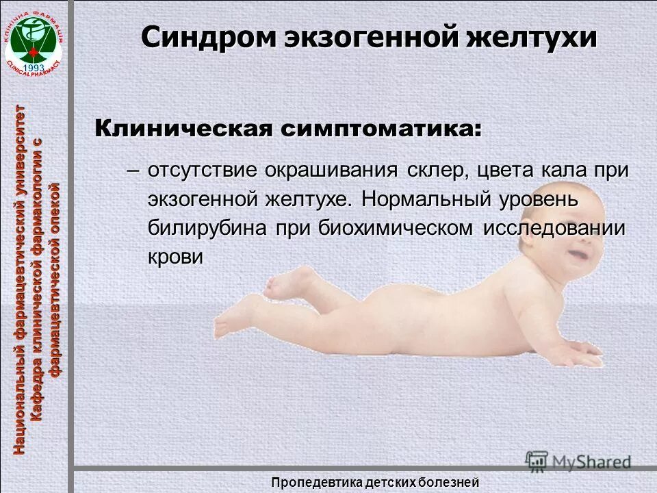 признаки обтурационной желтухи. дифференциальная диагностика механической, гемолитической желтухи. диф диагноз синдрома жильбера. желтухи пропедевтика. дифференциальная диагностика желтух схема.