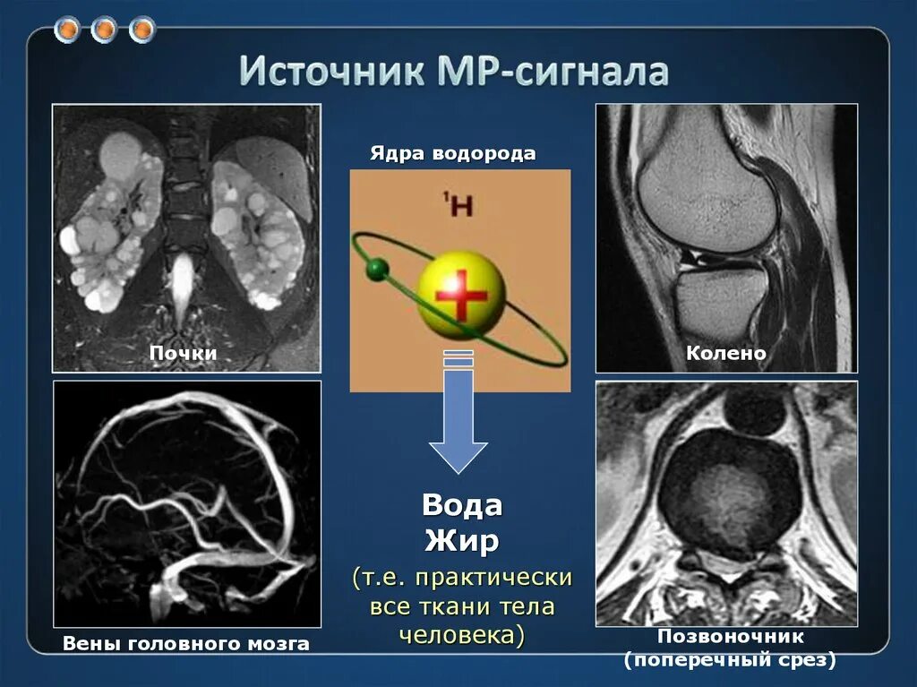 Мрт сигнал. Интенсивность мр сигнала. мрт интенсивность. сигналы мрт. тканевая интенсивность мр сигнала.
