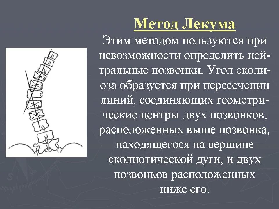 Угол сколиоза по чаклину рентген. Классификация сколиоза по чаклину. Измерение степени сколиоза по чаклину. Степени искривления позвоночника по коббу. Угол кобба