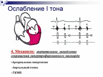 Ослабление сердечной