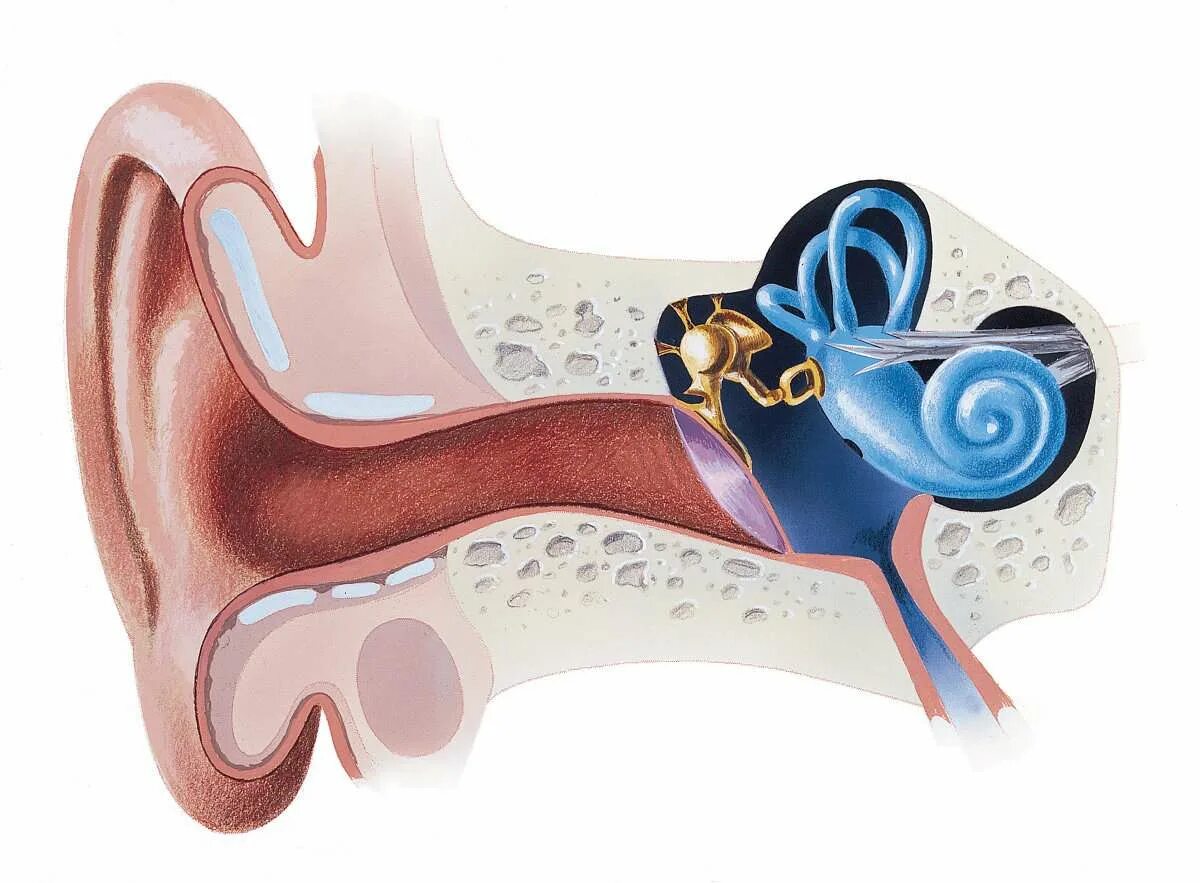 Болезни внутреннего уха Меньера. Гидропс внутреннего уха болезнь Меньера. Кохлеарный неврит барабанная перепонка. Болезнь Меньера внутреннее ухо. Слуховой аппарат внутреннего уха