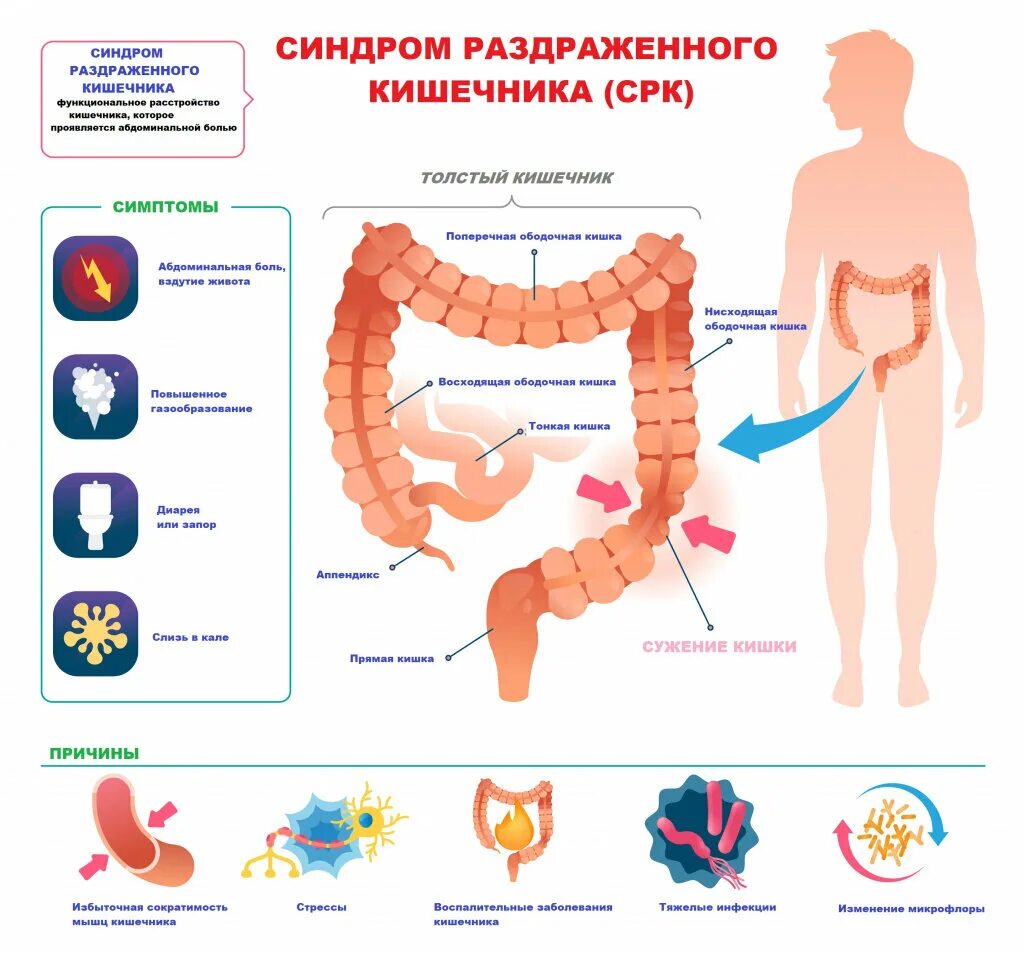 Боли при опорожнения кишечника. Синдром раздраженного кишечника. Функциональное расстройство кишечника. Синдром раздраженного Толстого кишечника. Проблемы с кишечником название болезней.