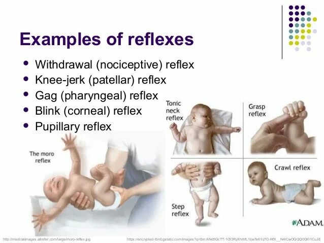 Как подавить рефлекс. Рефлекс Моро. Рефлекс Моро у новорожденных. Патологический рефлекс Моро. Рефлекс Моро угасание.