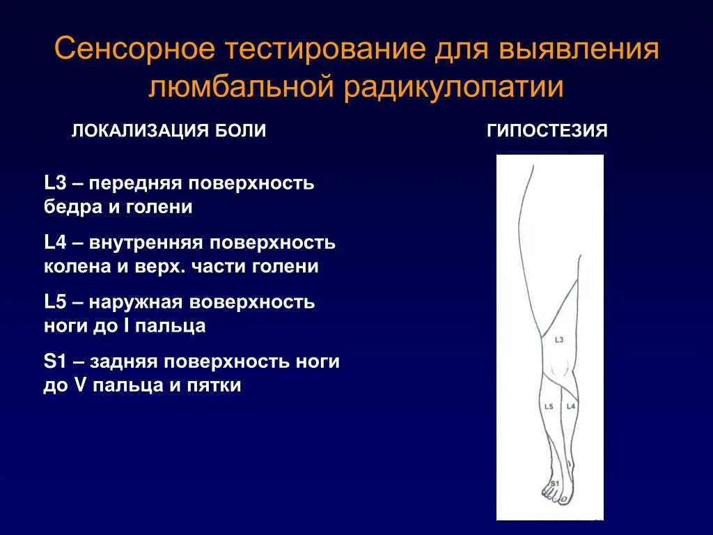 Радикулопатия клинические. Корешковый синдром. Гипестезия малоберцового нерва. Радикулопатии. Гипестезия по наружной передней поверхности голени.