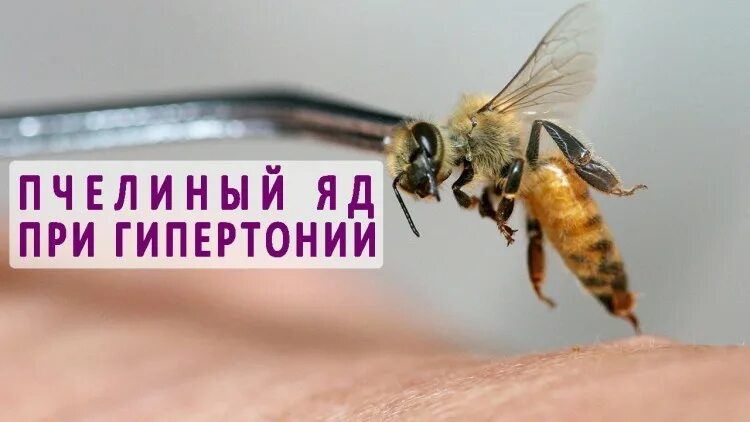 Пчелиный яд. Сбор пчелиного яда. Апитерапия. Лечение пчелиным ядом