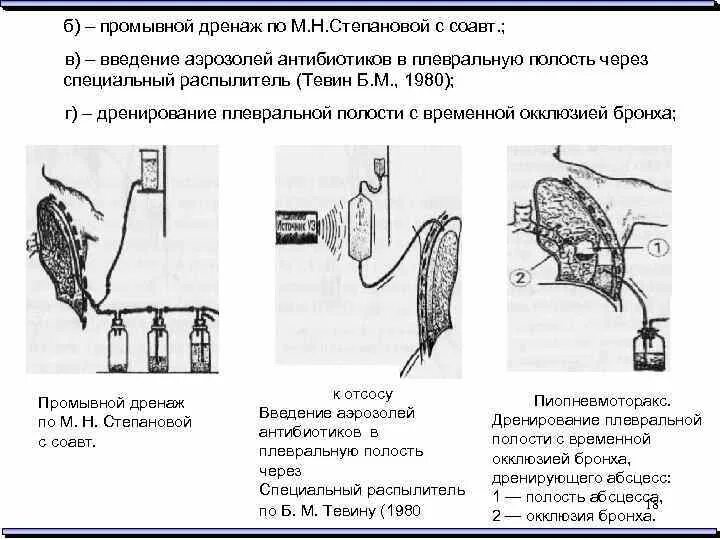 Дренирование гнойны ран. Дренирование полости по Бюлау. Дренирование плевральной полости с активной вакуум-аспирацией. Дренирование плевральной полости с активной аспирацией. Дренирование плевральной полости абсцесс.