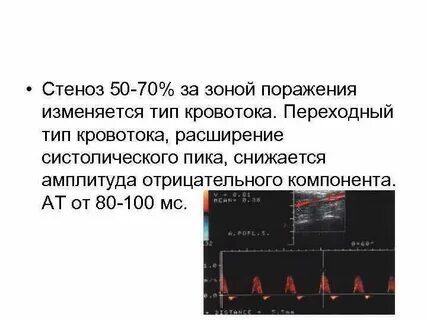 Типы кровотока