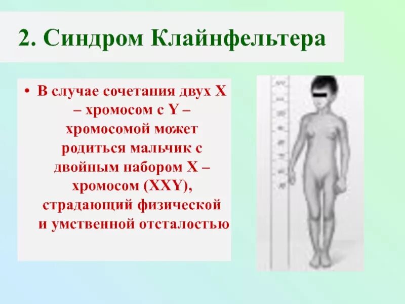 Синдром Клайнфельтера гетероплоидия. Синдром Клайнфельтера 47 xxy. Синдром Клайнфельтера у мужчин. Синдром Клайнфельтера схема хромосом.