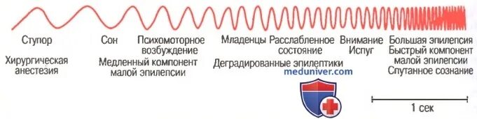 Волны мозговой активности. Гамма волны мозга. Бета волны головного мозга. Волновая активность мозга.