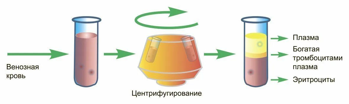 Prp-терапию (плазма обогащенная тромбоцитами). плазма обогащенная тромбоцитами. пробирки ycellbio. плазма обогащенная тромбоцитами prp. пробирка для плазмы prp.