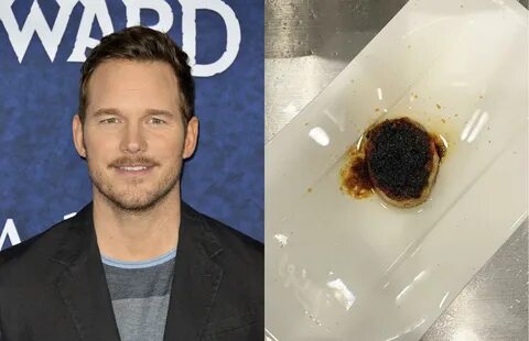 Epic celebrity food fails 