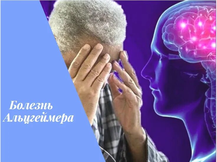 Нейродегенеративное заболевание головного. Нейродегенеративные расстройства. Нейродегенеративные заболевания головного мозга. Дебют нейродегенеративного заболевания головного мозга. Нейродегенеративные заболевания головного мозга в пожилом возрасте.