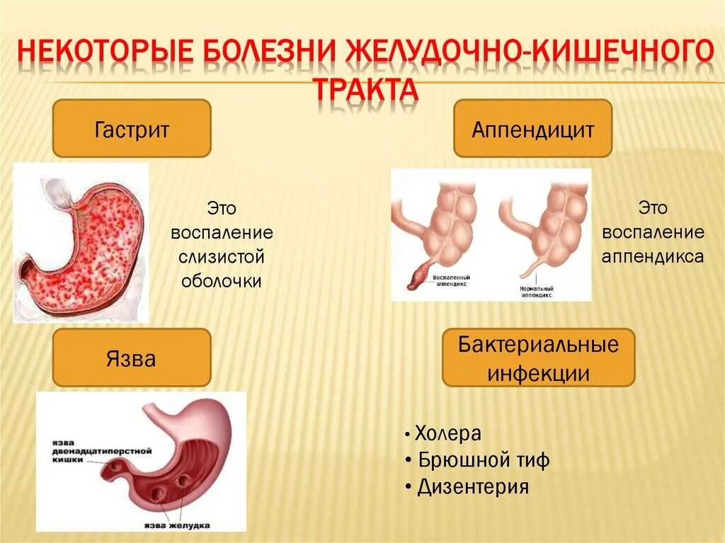 Заболевания пищеварительной системы. Заболевания пищеварительной системы человека. Заболевания органов ЖКТ. Болезни органов пищеварительной системы. Гастрит лекция