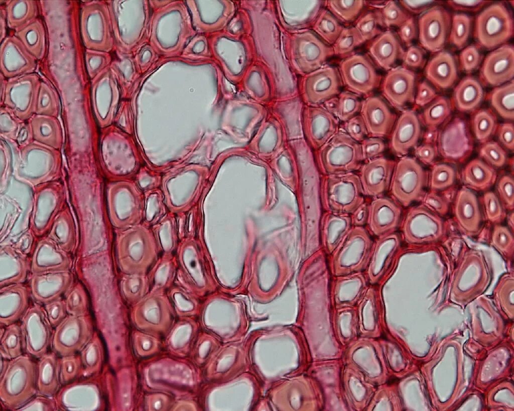Микрофото ксилемы. Ксилема гистология. Ксилема микропрепарат. Ксилема и флоэма гистология.