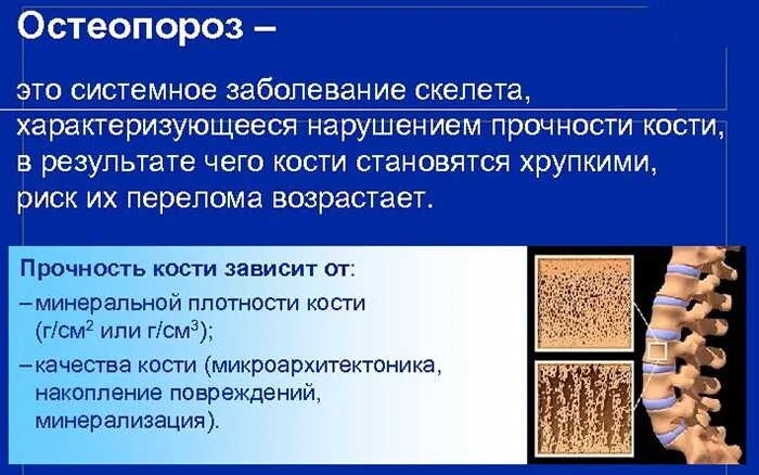 Симптомы остеопороза у женщин после 50 лет. Остеопороз. Остеопороз симптомы. Признаки остеопороза. Синдром остеопороза.