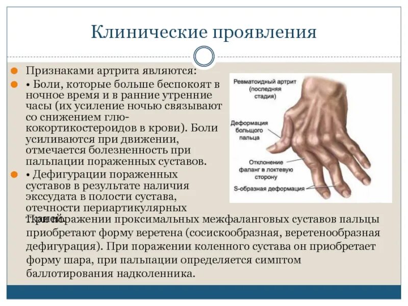 Ревматоидный артрит специфические симптомы. Ревматоидный артрит основные клинические симптомы. Клинические проявления ревматоидного артрита симптомы. Ревматический артрит симптомы. Диагноз болей в стопе