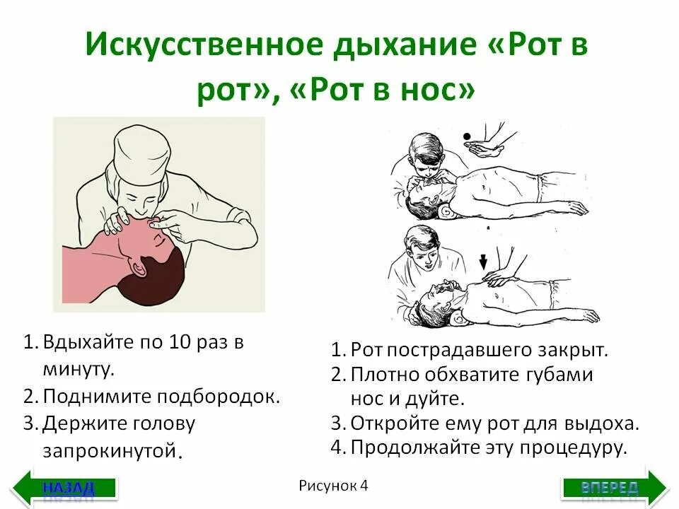 Искусственное дыхание проводится в следующих случаях. Схема оказания искусственного дыхания. При проведении искусственного дыхания способом рот в нос необходимо. Искусственное дыхание способы схема.