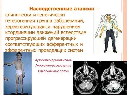 Что такое атаксия у человека симптомы лечение