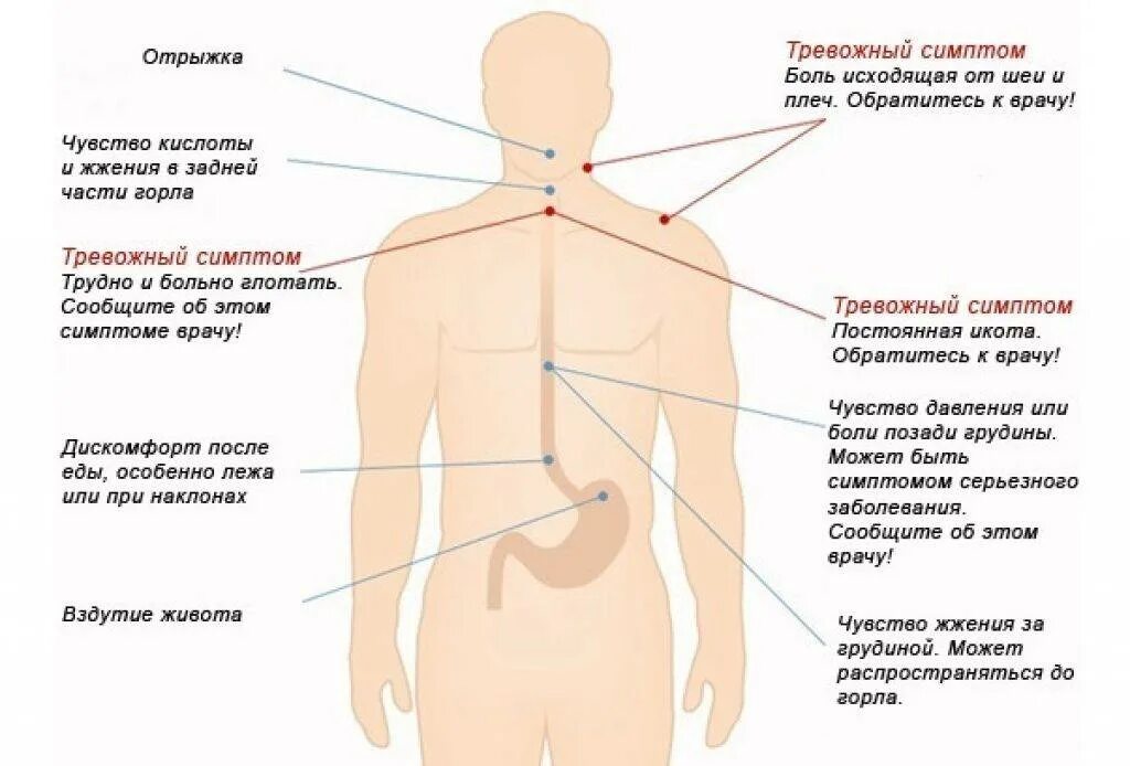 Боль в области желудка и спины. Боли при изжоге локализация.