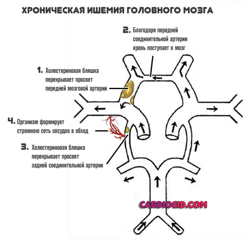 Виллизиев круг вариант развития на мрт. Сегменты передней мозговой артерии схема мрт. Сегменты Виллизиева круга мрт. Нормы кровотока артерий Виллизиева круга. Соединительные артерии Виллизиева круга.