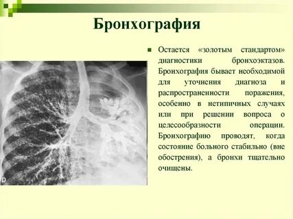 Усиление сосудистого рисунка