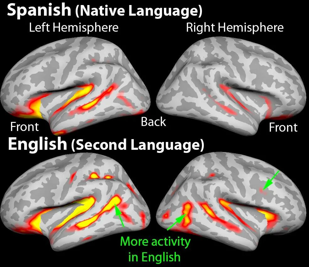 Brain languages. Язык и мозг. Билингвизм мозг. Мозг монолингва. Bilingual Brains картинки.