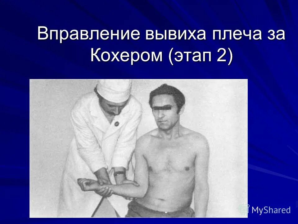 Вывих плечевого сустава методы вправления. Гиппократ вправление вывихов. Вправление вывиха плечевого сустава по джанелидзе. Вправление вывиха плечевого сустава по джанелидзе. Вывих тазобедренного сустава (метод джанелидзе).