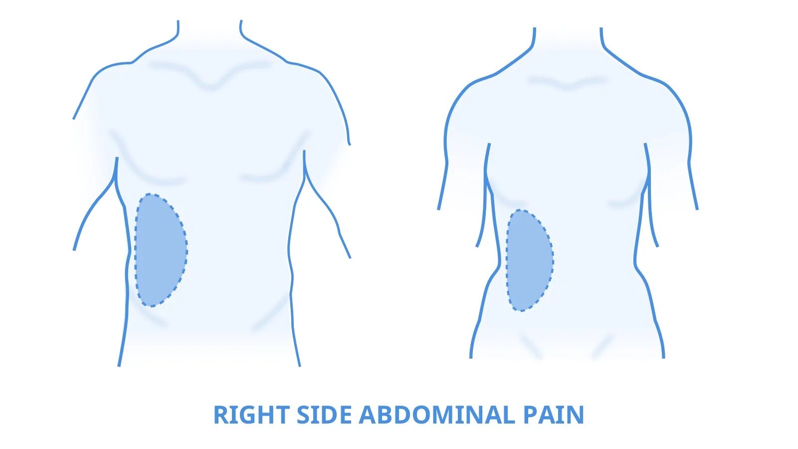 Be on the right side. Right side. supradiaphragmatic region on the right side. on the right side.