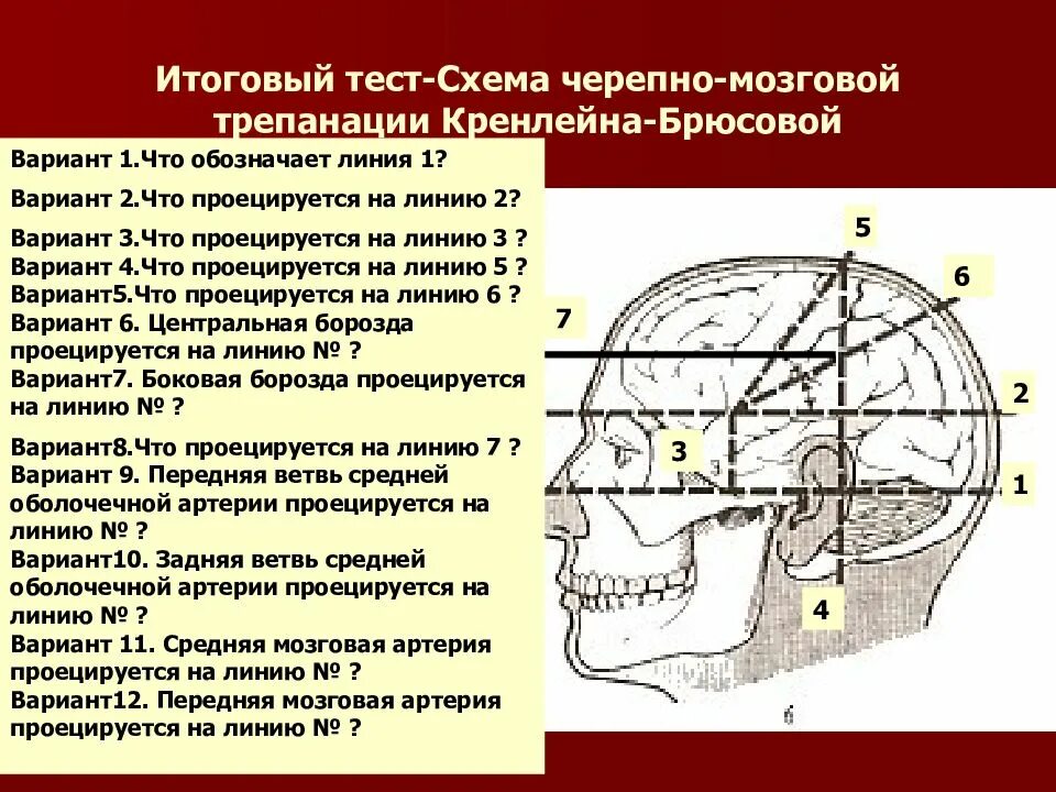 Проекция средней менингеальной артерии. Проекцию средней менингеальной артерии по схеме кренлейна-брюсовой. Схема черепно-мозговой топографии кренлейна-брюсовой. Проекция средней менингеальной артерии. Проекция средней менингеальной артерии.