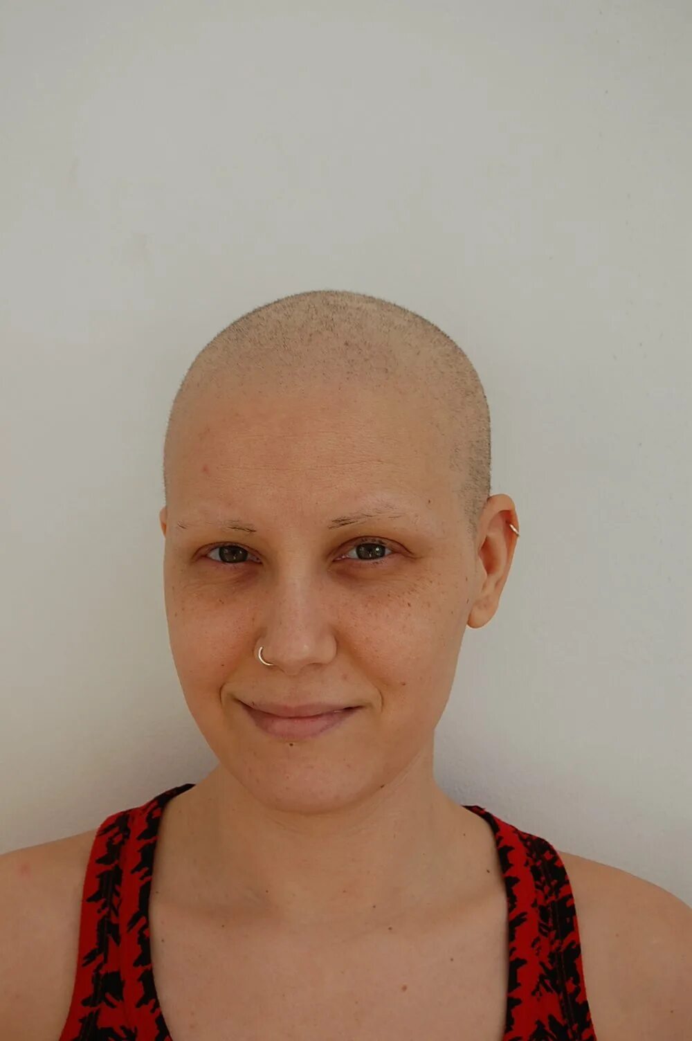 Волосы на голове после химиотерапии. Волосы после химиотерапии. Прическа после химиотерапии. Короткие стрижки после химиотерапии. Стрижка после химиотерапии на короткие волосы.