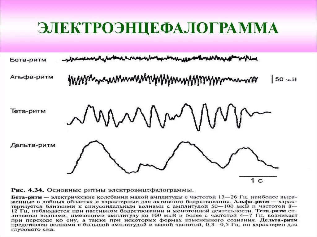 Описание ээг. Расшифровка показателей электроэнцефалограммы ЭЭГ головного мозга. Дельта активность на ЭЭГ У взрослых. ЭЭГ нормальные показатели у подростка. ЭЭГ головного мозга ребенка расшифровка показателей норма.