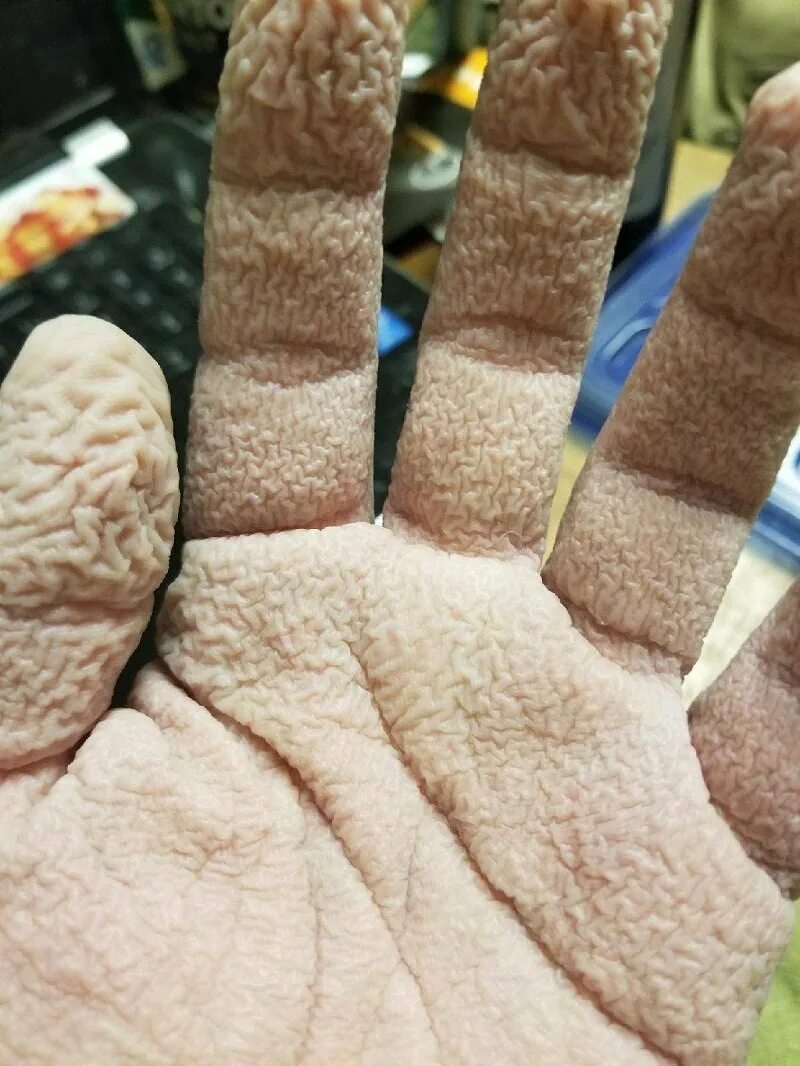 Почему морщатся руки. Сморщенная кожа на пальцах.