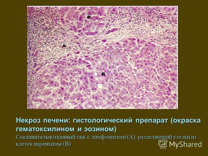 Окрашивание препаратов в гистологии. Почка (гематоксилин-эозин) препарат гистология. Почка крысы окраска гематоксилином и эозином. Методы окраски гистологических препаратов. Окраски препаратов гистология.