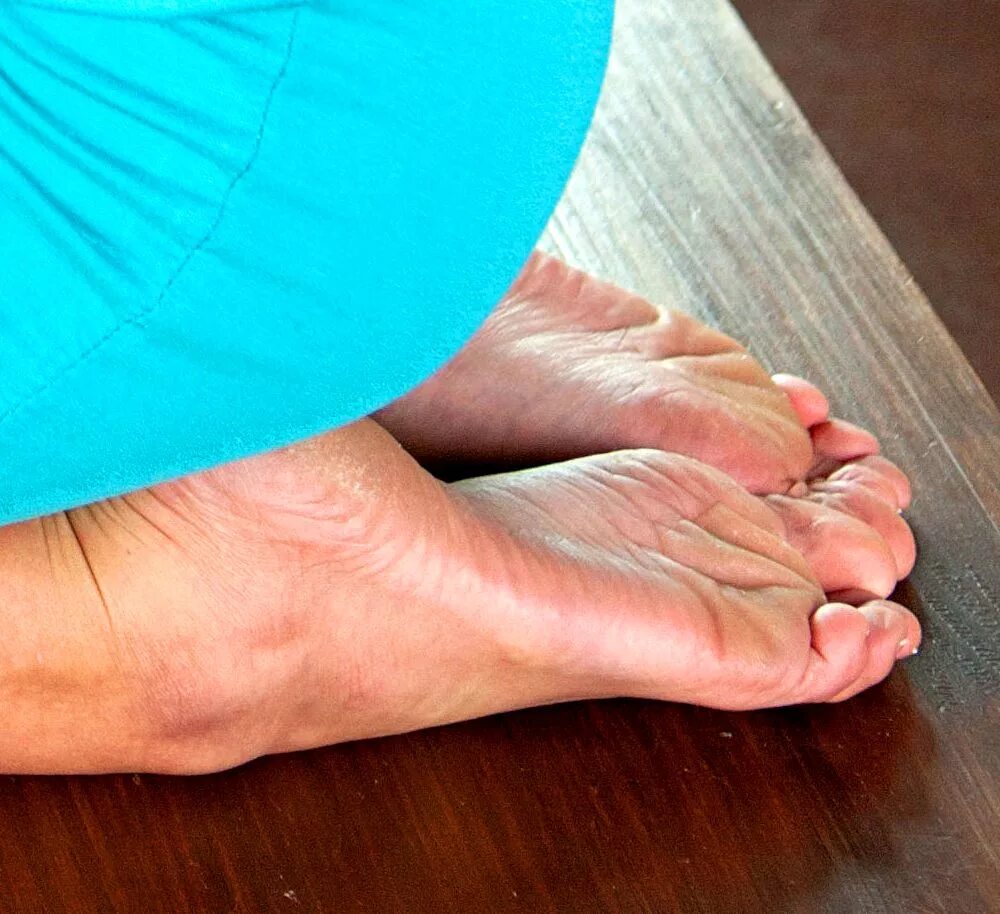 Старые ноги женщин
