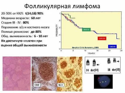 Нефолликулярная лимфома