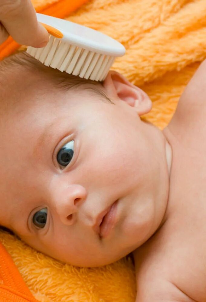 Обработка головы при гнейсе. Корочки на голове у младенца. Обработка головы при гнейсе. Обработка головы при гнейсе. Обработка волосистой части головы новорожденного алгоритм.